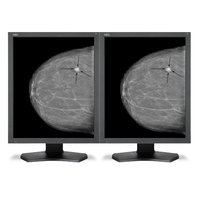 NEC NEC MDG5-BNDL1 Computerbildschirm 54,1 cm (21.3 Zoll) 2048 x 2560 Pixel Schwarz http://images.icecat.biz/img/norm/low/12362852-6761.jpg