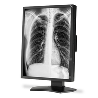 NEC NEC MD211G3 54,1 cm (21.3 Zoll) 2048 x 1536 Pixel Schwarz http://images.icecat.biz/img/norm/low/14116398-1635.jpg NEC NEC MD211G3 54,1 cm (21.3 Zoll) 2048 x 1536 Pixel Schwarz http://images.icecat.biz/img/norm/low/14116398-1635.jpg