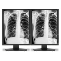 NEC NEC MDG3-BNDA1 LED display 54,1 cm (21.3 Zoll) 2048 x 1536 Pixel Schwarz http://images.icecat.biz/img/norm/low/17858960-8125.jpg NEC NEC MDG3-BNDA1 LED display 54,1 cm (21.3 Zoll) 2048 x 1536 Pixel Schwarz http://images.icecat.biz/img/norm/low/17858960-8125.jpg