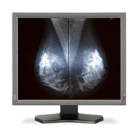 NEC NEC MD211G5 54,1 cm (21.3 Zoll) 2048 x 2560 Pixel Schwarz http://images.icecat.biz/img/norm/low/18144893-4376.jpg NEC NEC MD211G5 54,1 cm (21.3 Zoll) 2048 x 2560 Pixel Schwarz http://images.icecat.biz/img/norm/low/18144893-4376.jpg