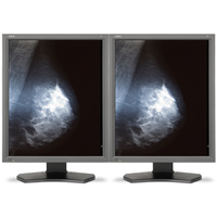 NEC NEC MDG5-BNDN1 Computerbildschirm 53,3 cm (21 Zoll) 2048 x 2560 Pixel Grau http://images.icecat.biz/img/norm/low/19626008-6724.jpg NEC NEC MDG5-BNDN1 Computerbildschirm 53,3 cm (21 Zoll) 2048 x 2560 Pixel Grau http://images.icecat.biz/img/norm/low/19626008-6724.jpg