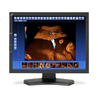 NEC NEC MD210C2 54,1 cm (21.3 Zoll) 1600 x 1200 Pixel Schwarz http://images.icecat.biz/img/norm/low/20728438-1085.jpg NEC NEC MD210C2 54,1 cm (21.3 Zoll) 1600 x 1200 Pixel Schwarz http://images.icecat.biz/img/norm/low/20728438-1085.jpg