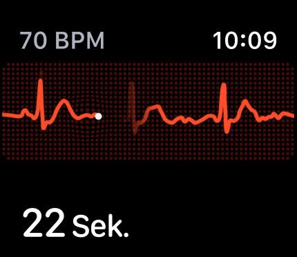 Mach ein EKG. Jederzeit.