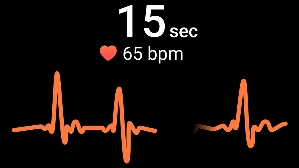 A heart monitoring package that watches over you