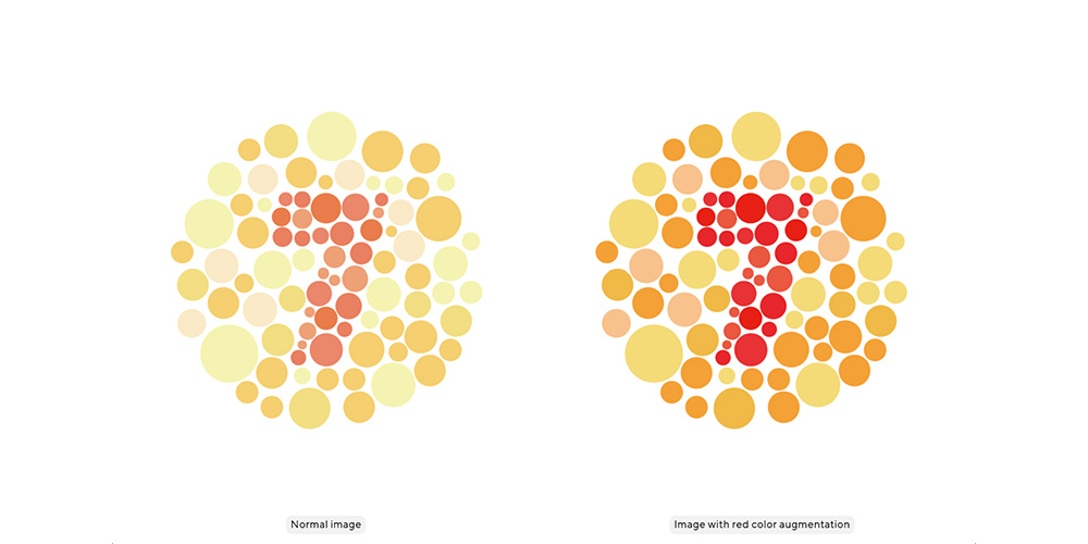 Colour Augmentation
