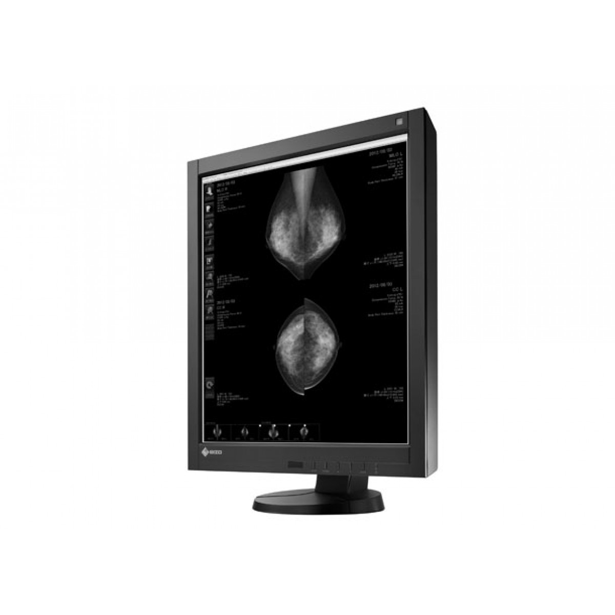 EIZO RadiForce GX540