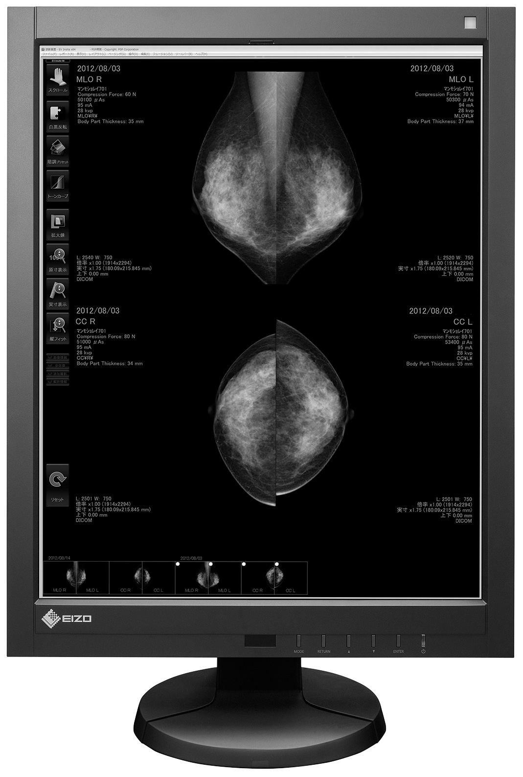 EIZO RadiForce GX540 – image 2