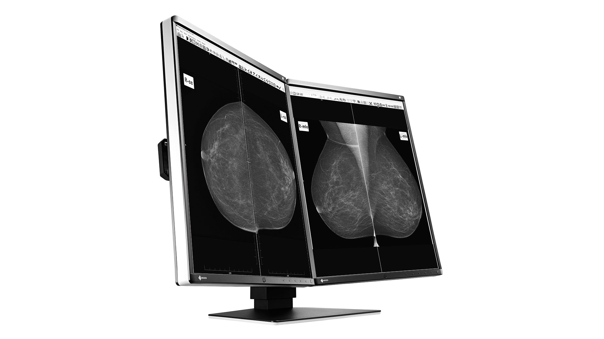 EIZO RadiForce GX560-MD computer monitor – image 2