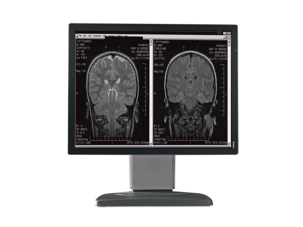 Barco MDCG-2121 computer monitor