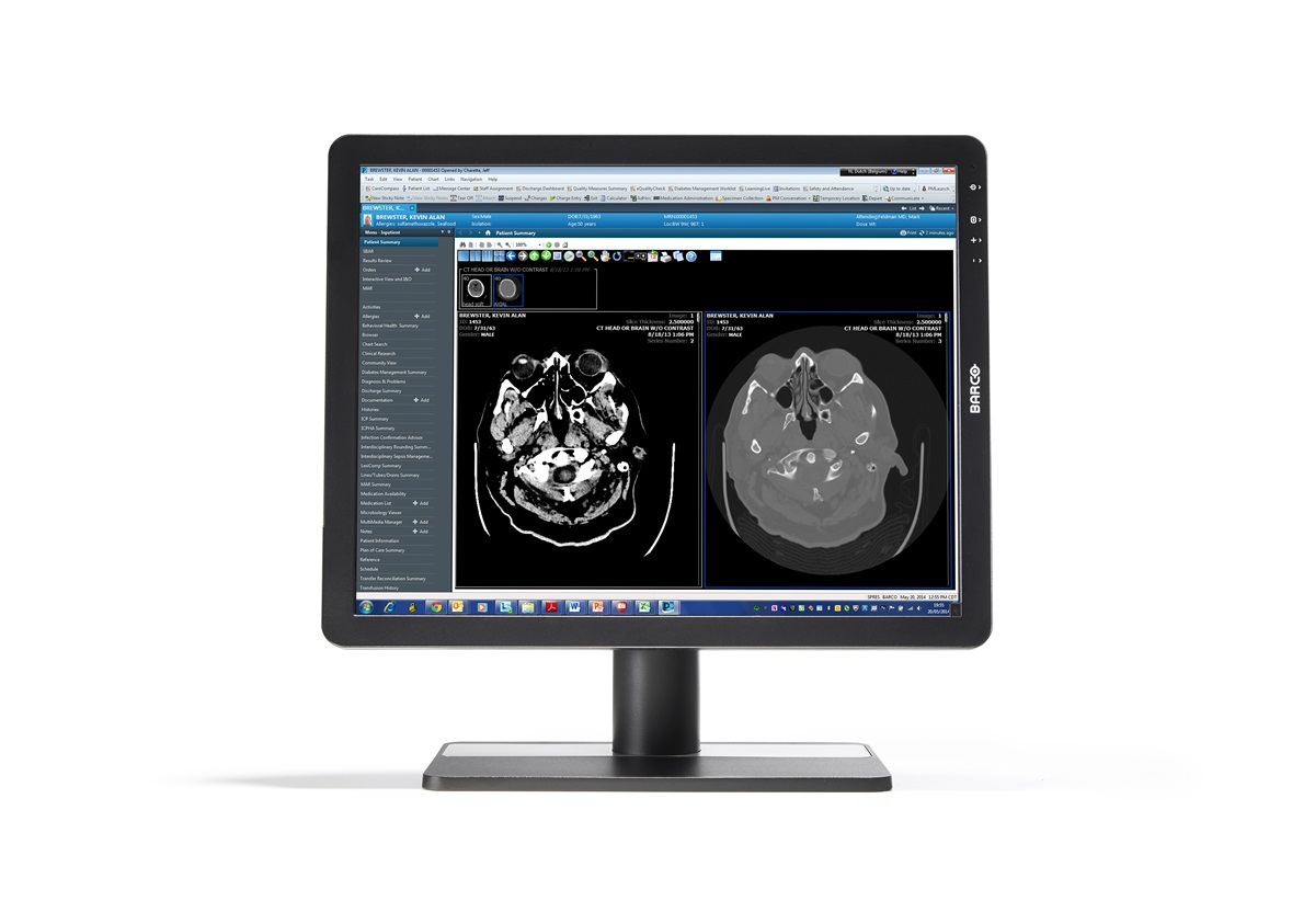 Barco MDRC-2221 computer monitor