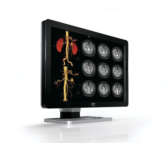 Barco MDCC-4130 computer monitor