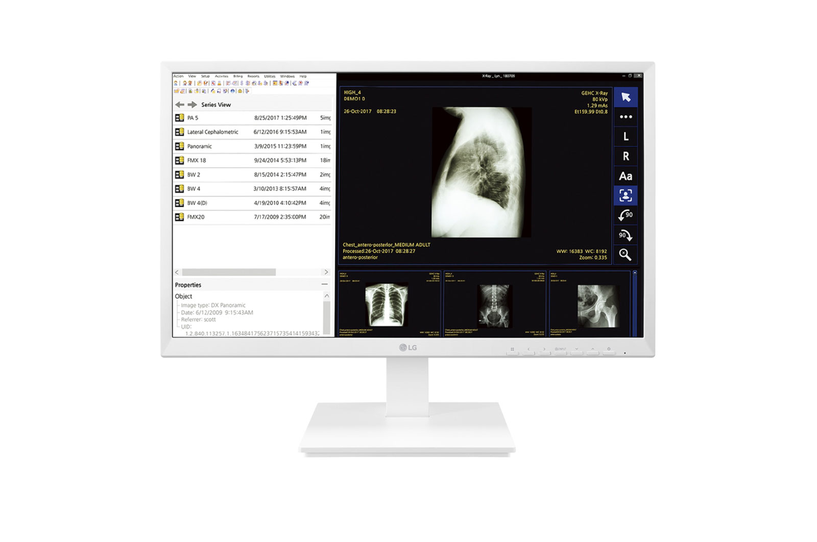 LG 24CK560N-3A All-in-One PC/workstation AMD G