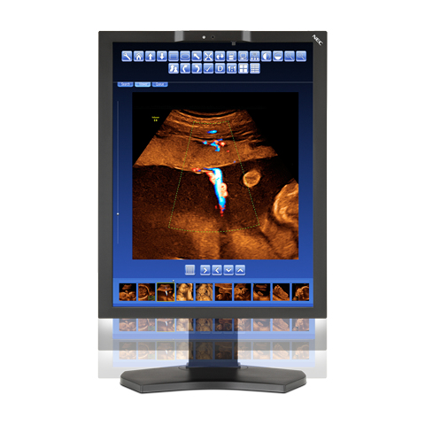 NEC MD210C2 computer monitor – image 2