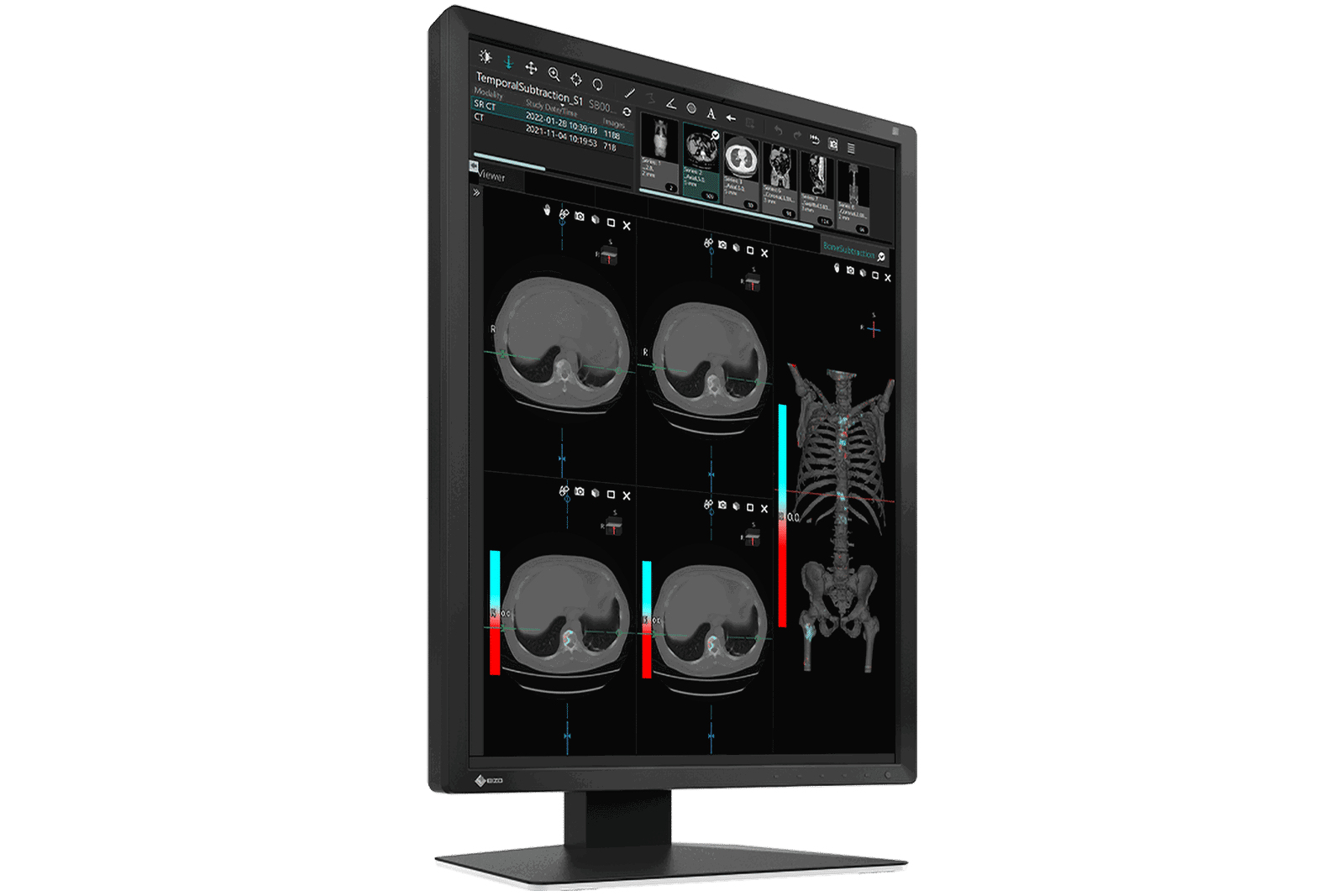 EIZO RadiForce MX217-BK computer monitor – image 5