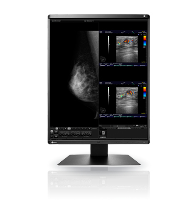 EIZO RadiForce RX560 computer monitor