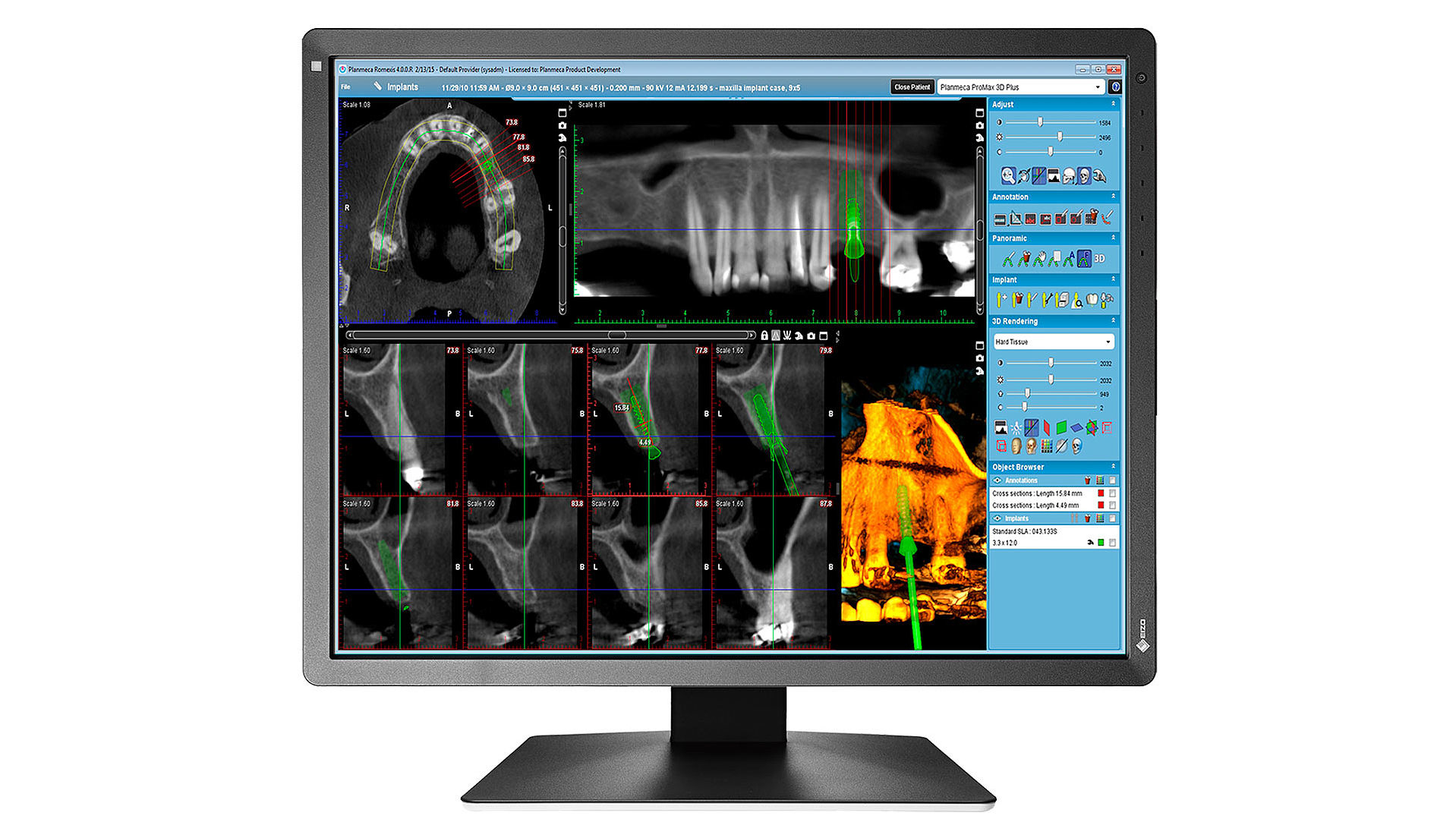 EIZO RadiForce MX216-SB computer monitor – image 2