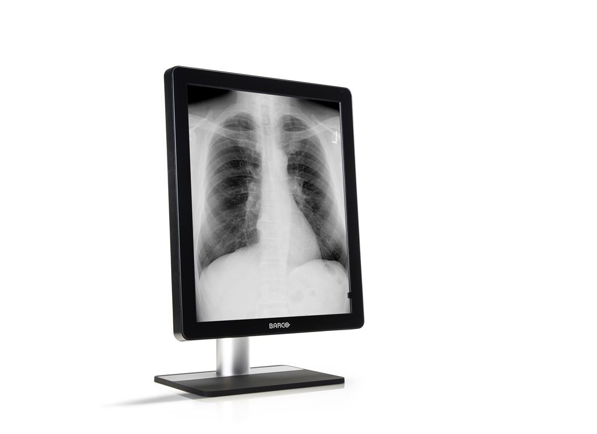Barco MDCG-5221 computer monitor – image 1