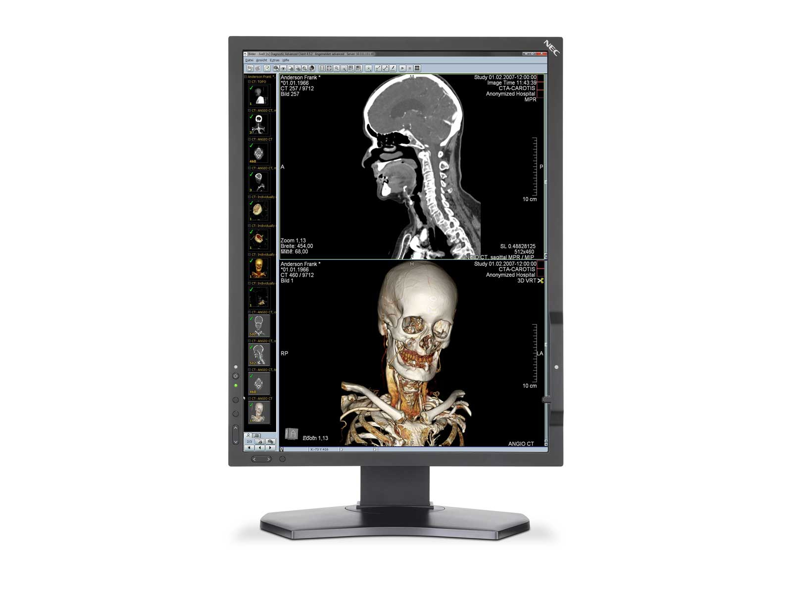 NEC MultiSync MDC212C2-270 computer monitor – image 1