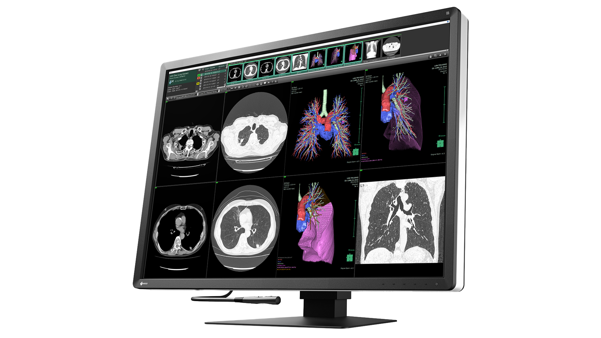 EIZO RadiForce RX1270 computer monitor – image 4