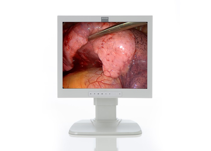 Barco E192HSA computer monitor
