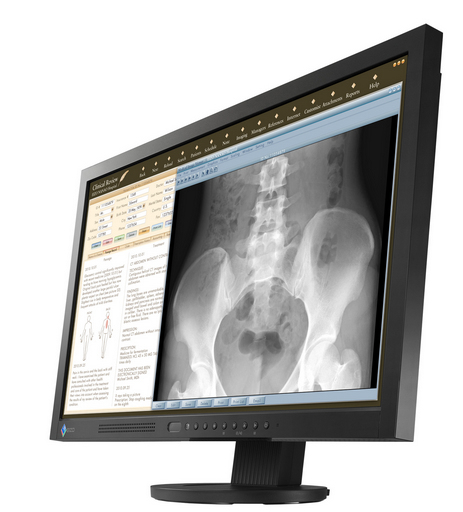 EIZO RadiForce MS230W 23" – image 2