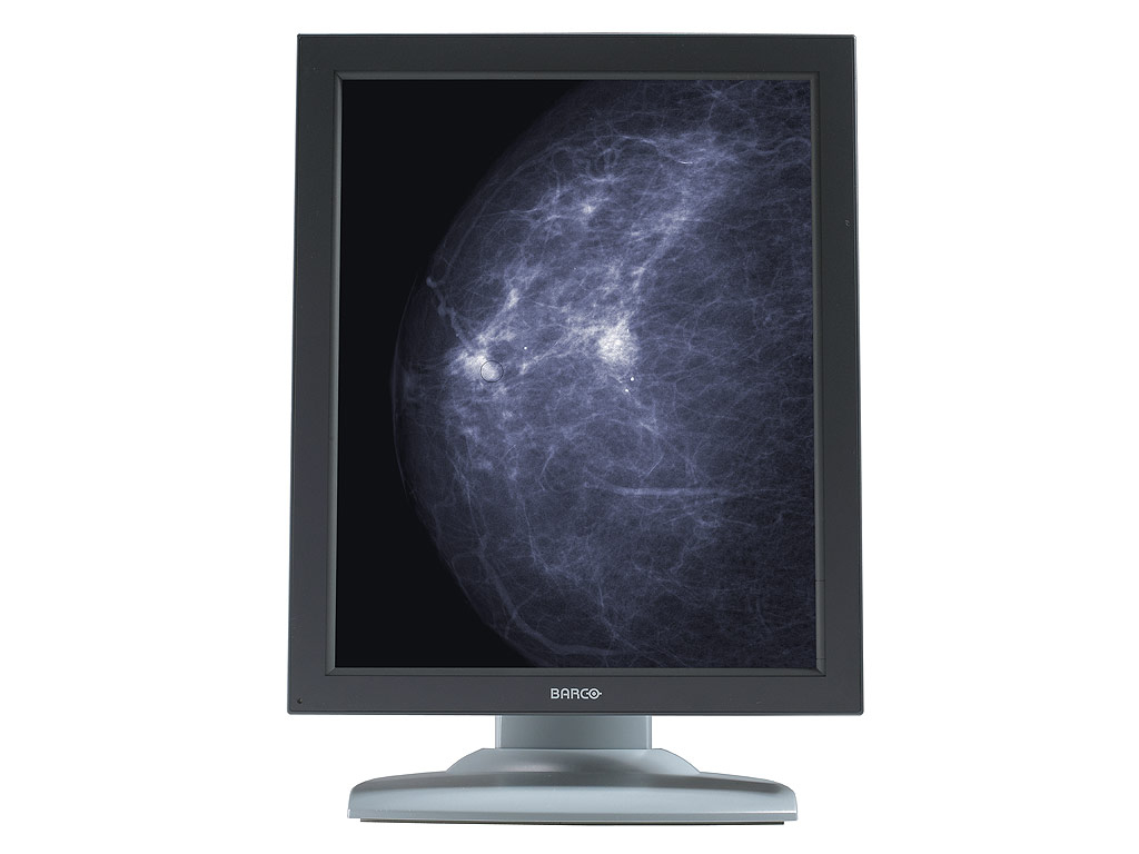 Barco MDNG-6121 computer monitor