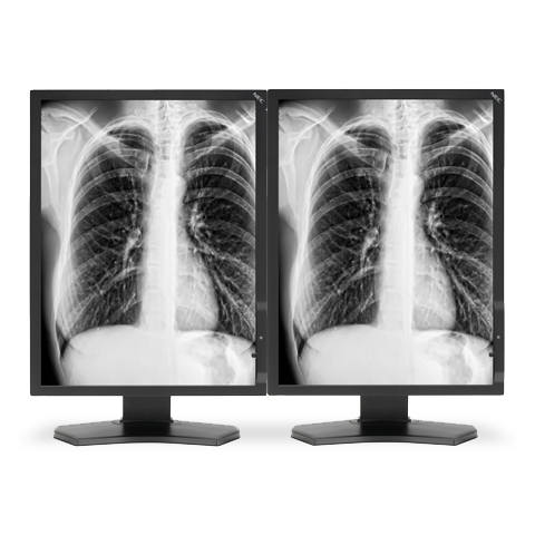 NEC MDG3-BNDL1 computer monitor