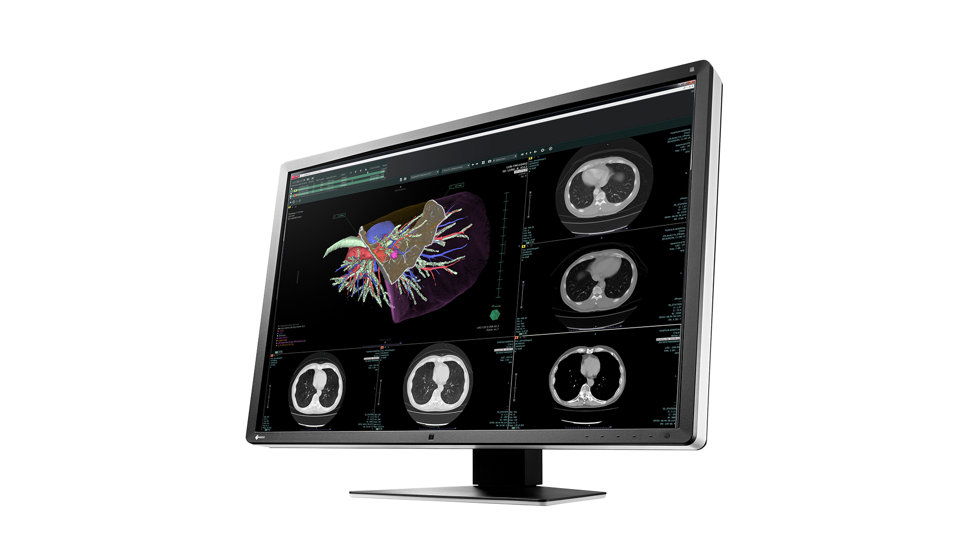 EIZO RadiForce RX660 computer monitor – image 6