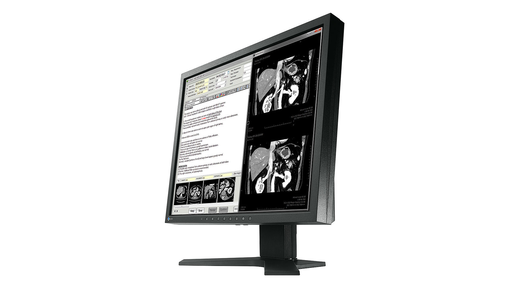 EIZO RadiForce MX194 computer monitor – image 4