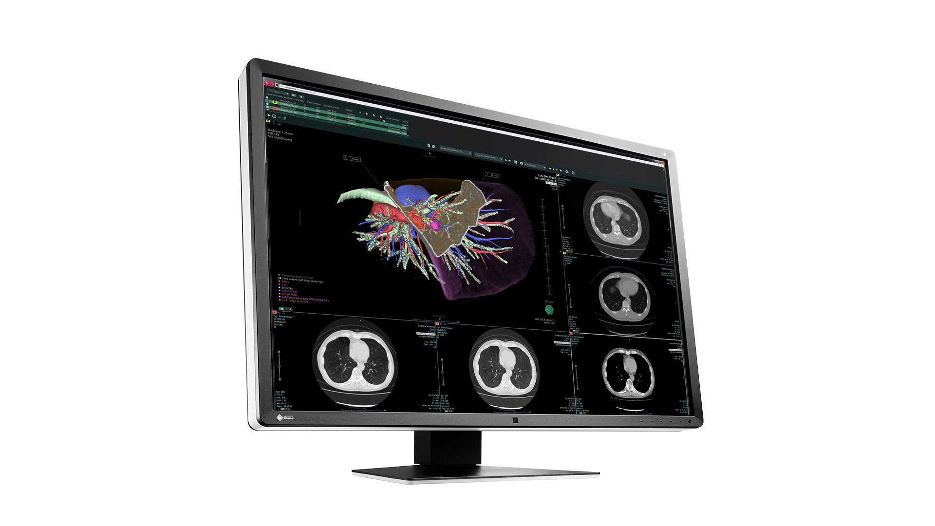 EIZO RadiForce RX660 computer monitor – image 3