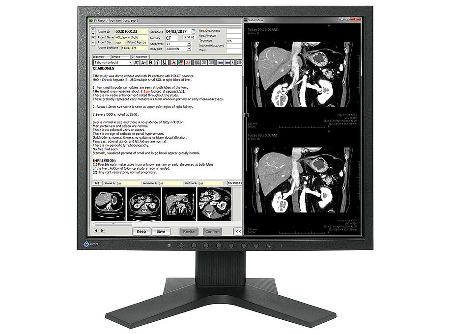 EIZO RadiForce MX194 computer monitor – image 1
