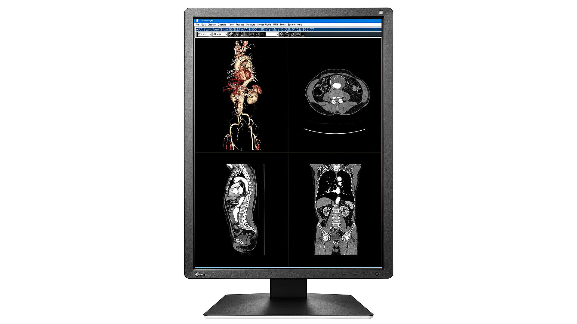 EIZO RadiForce MX216-SB computer monitor – image 4