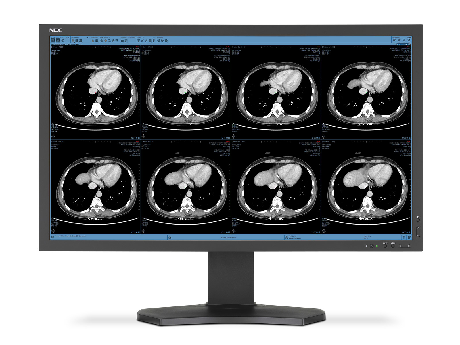NEC MD322C8-2 computer monitor – image 5