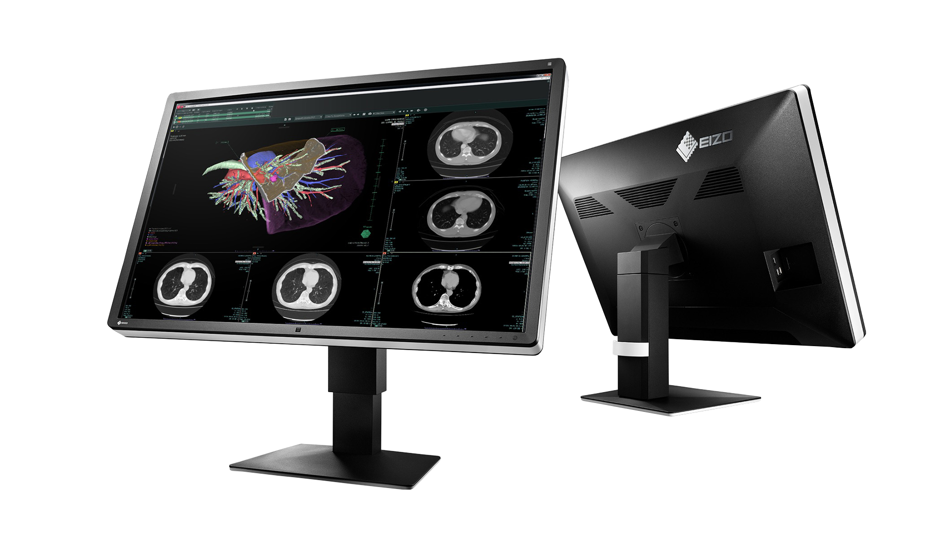 EIZO RadiForce RX660 computer monitor – image 2