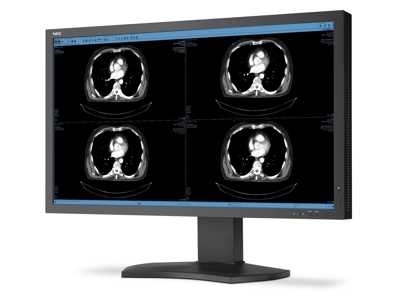 NEC MD322C8-2 computer monitor – image 7