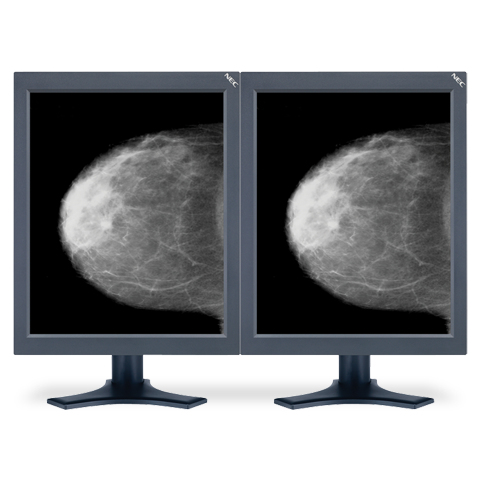 NEC MDG5MP-BNDL computer monitor