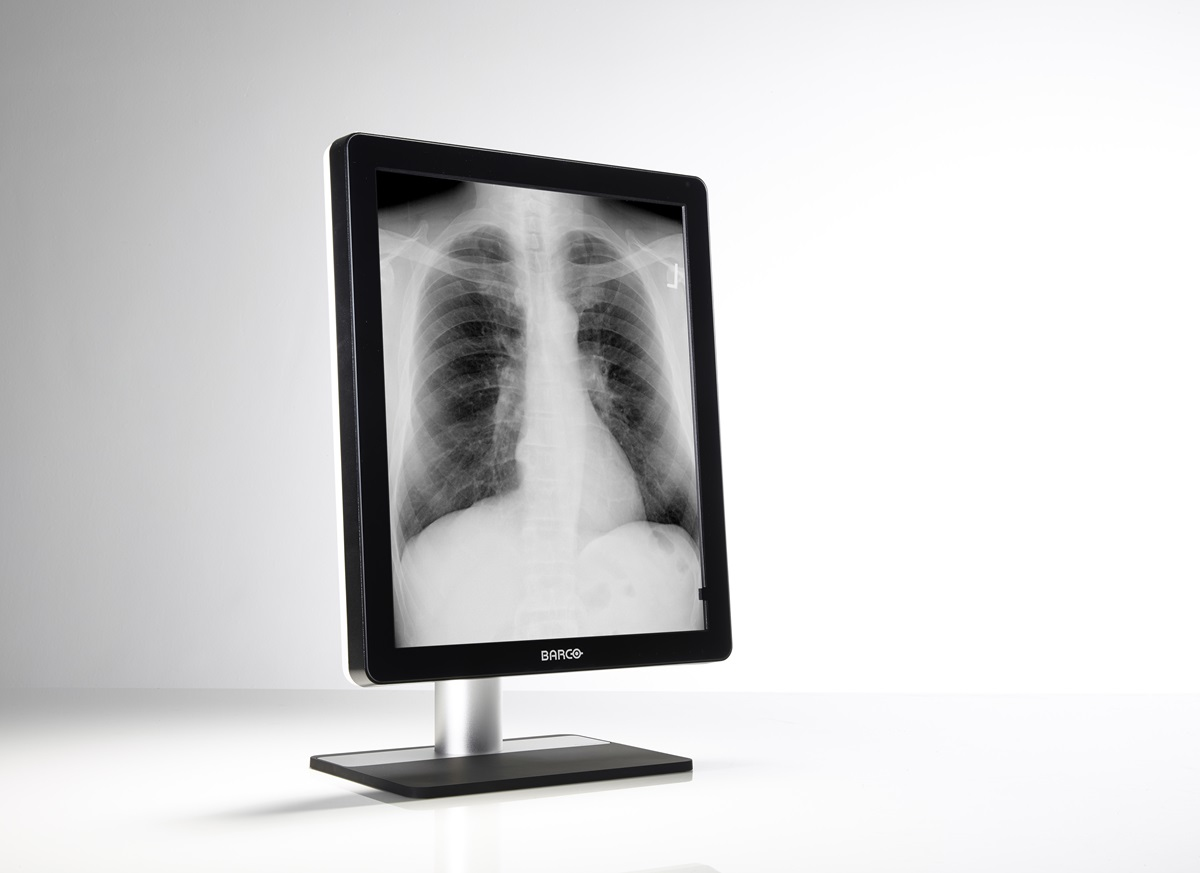 Barco MDCG-5221 computer monitor – image 2