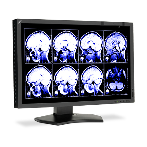 NEC MD242C2 computer monitor – image 3