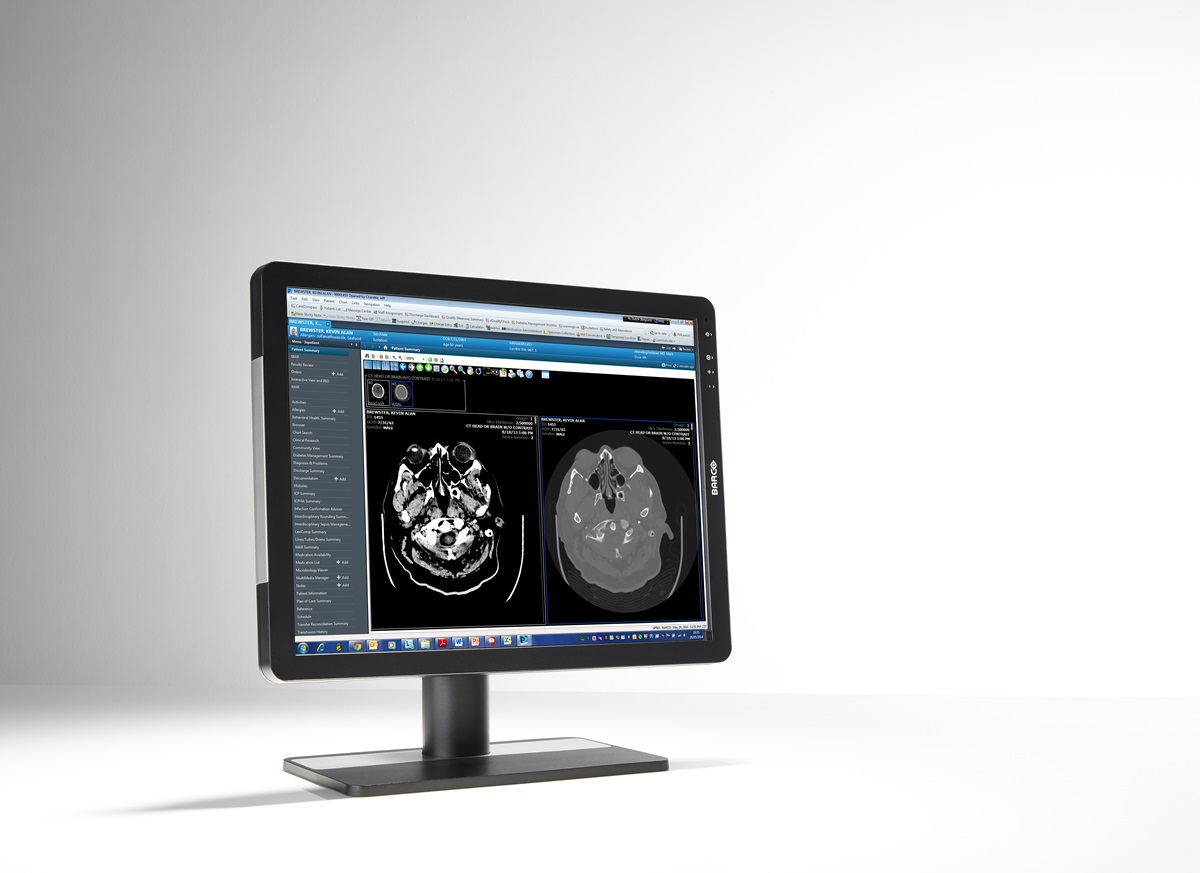 Barco MDRC-2221 computer monitor – image 2