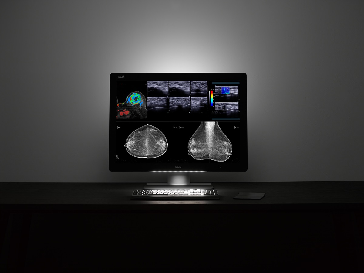 Barco MDMC-12133 computer monitor – image 2