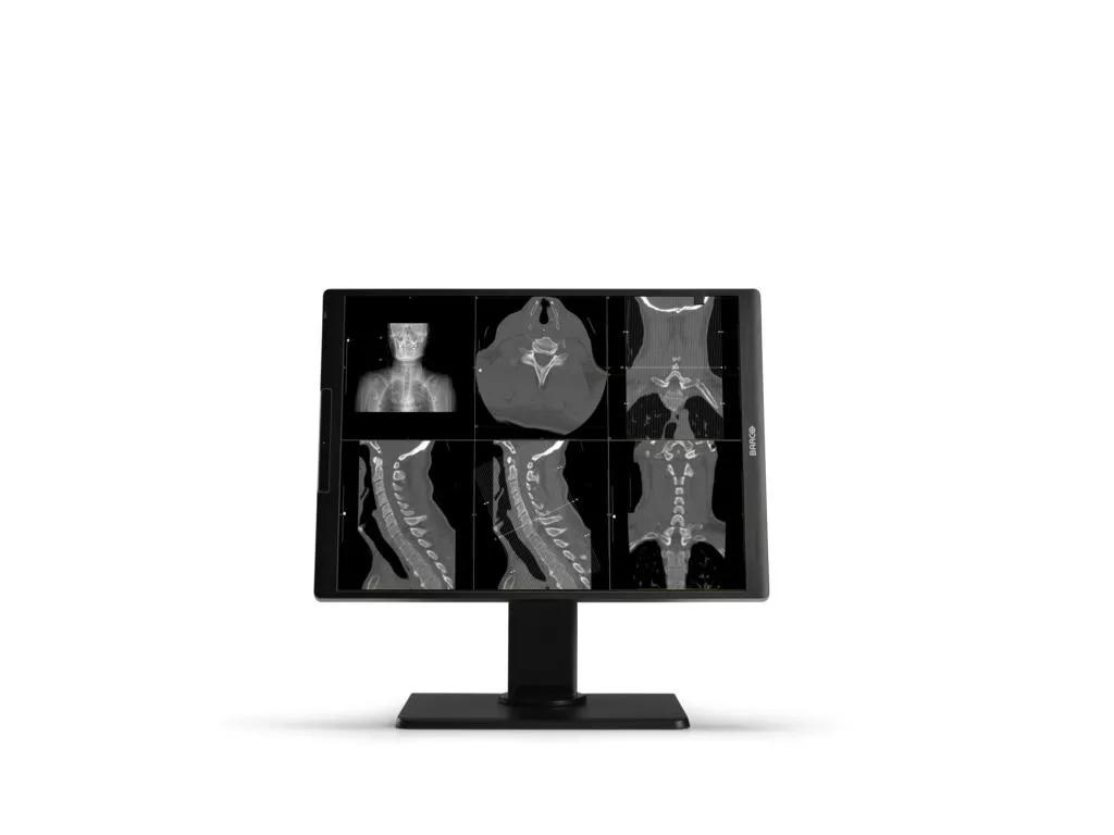 Barco MDNC‑2521 computer monitor – image 3