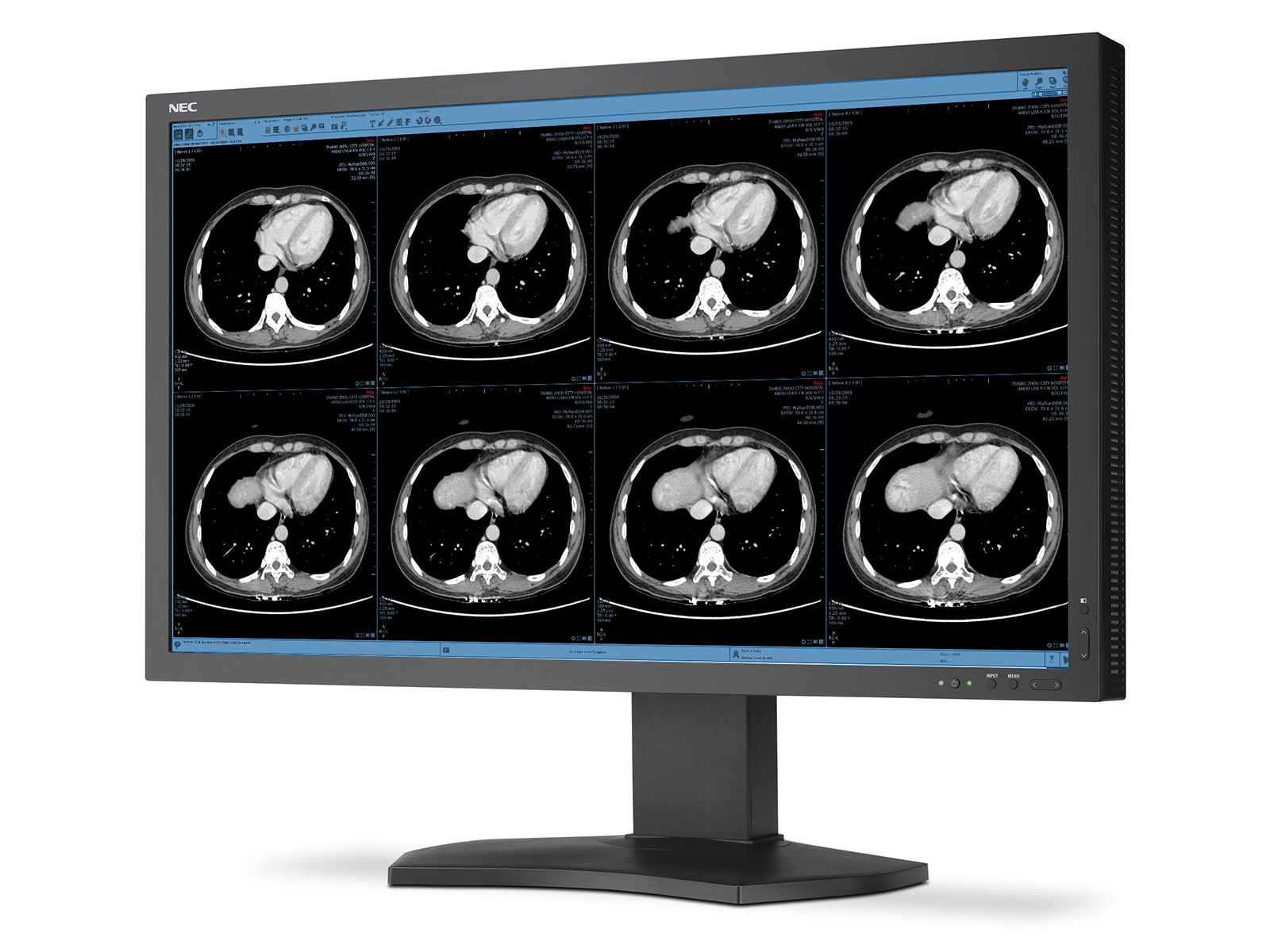 NEC MD322C8-2 computer monitor