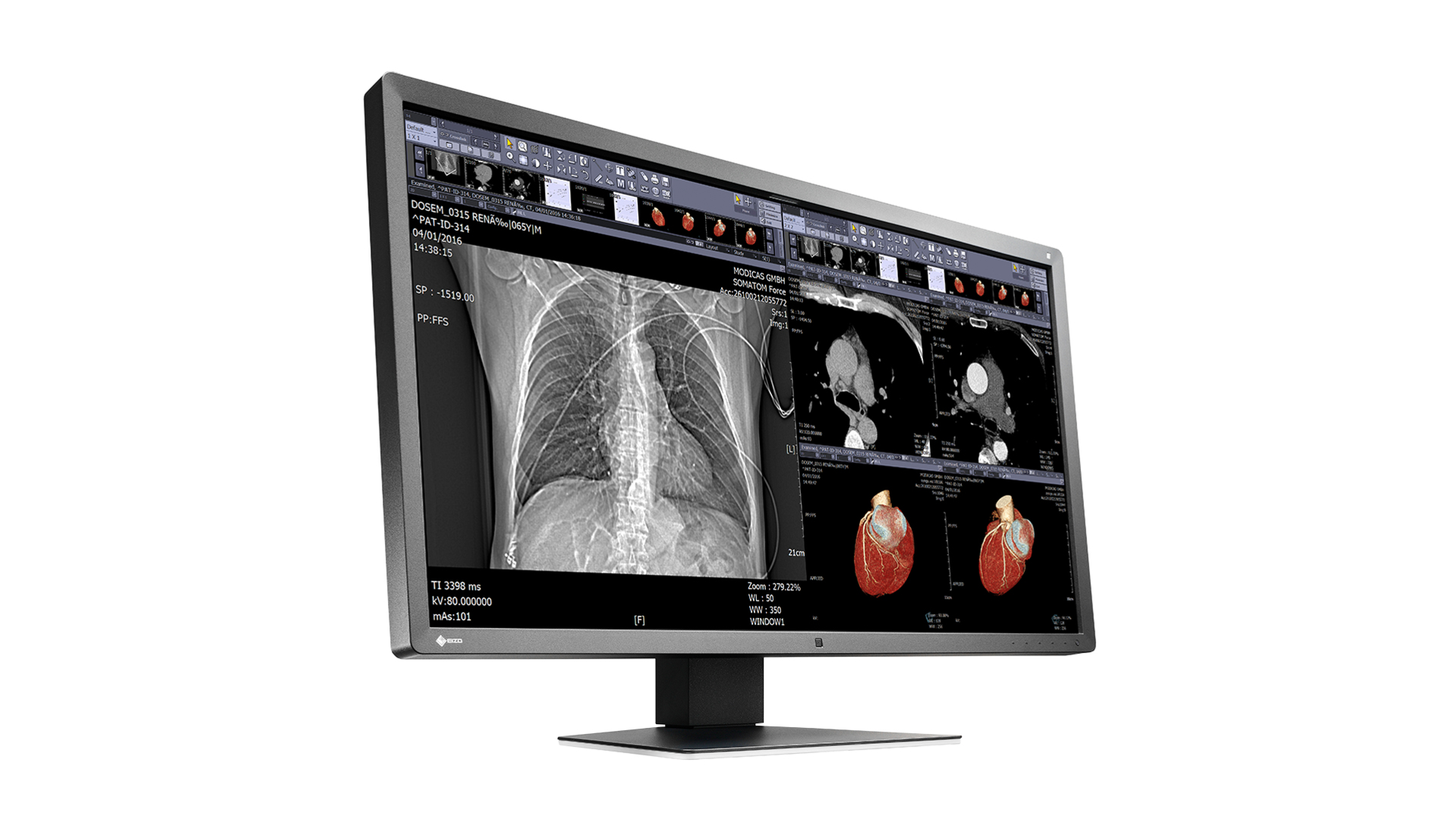 EIZO RadiForce MX315W computer monitor – image 7