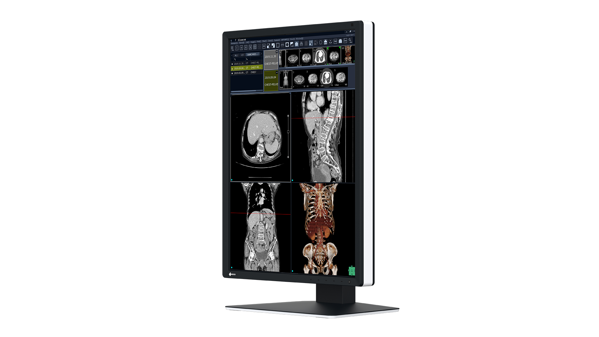 EIZO RadiForce RX270 computer monitor – image 2