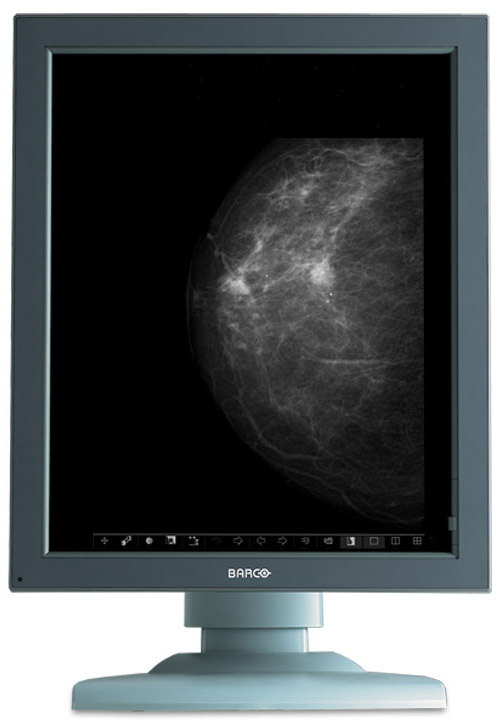 Barco MDMG-5121 computer monitor