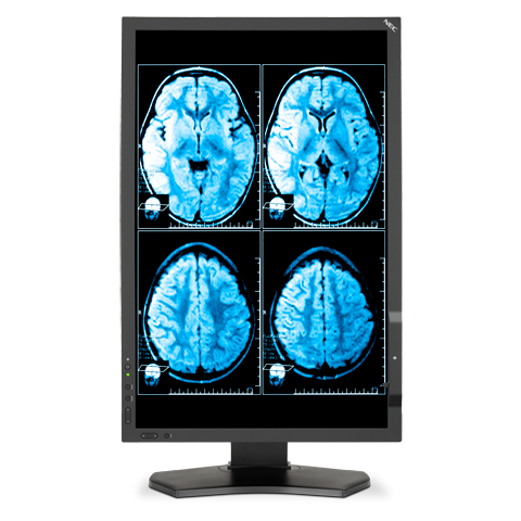 NEC MD242C2 computer monitor – image 5