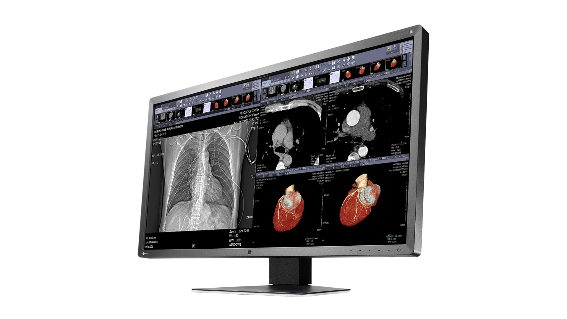 EIZO RadiForce MX315W computer monitor – image 2