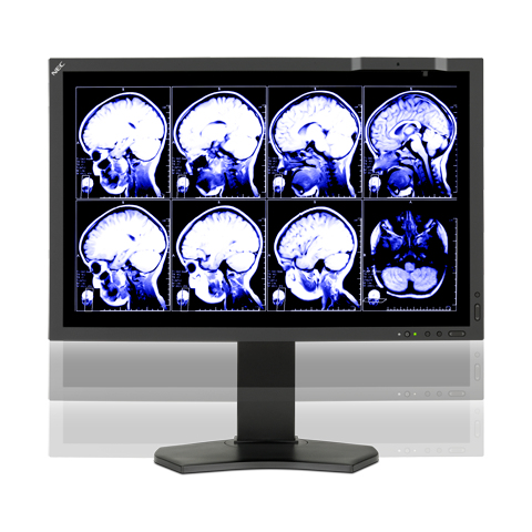 NEC MD242C2 computer monitor – image 2