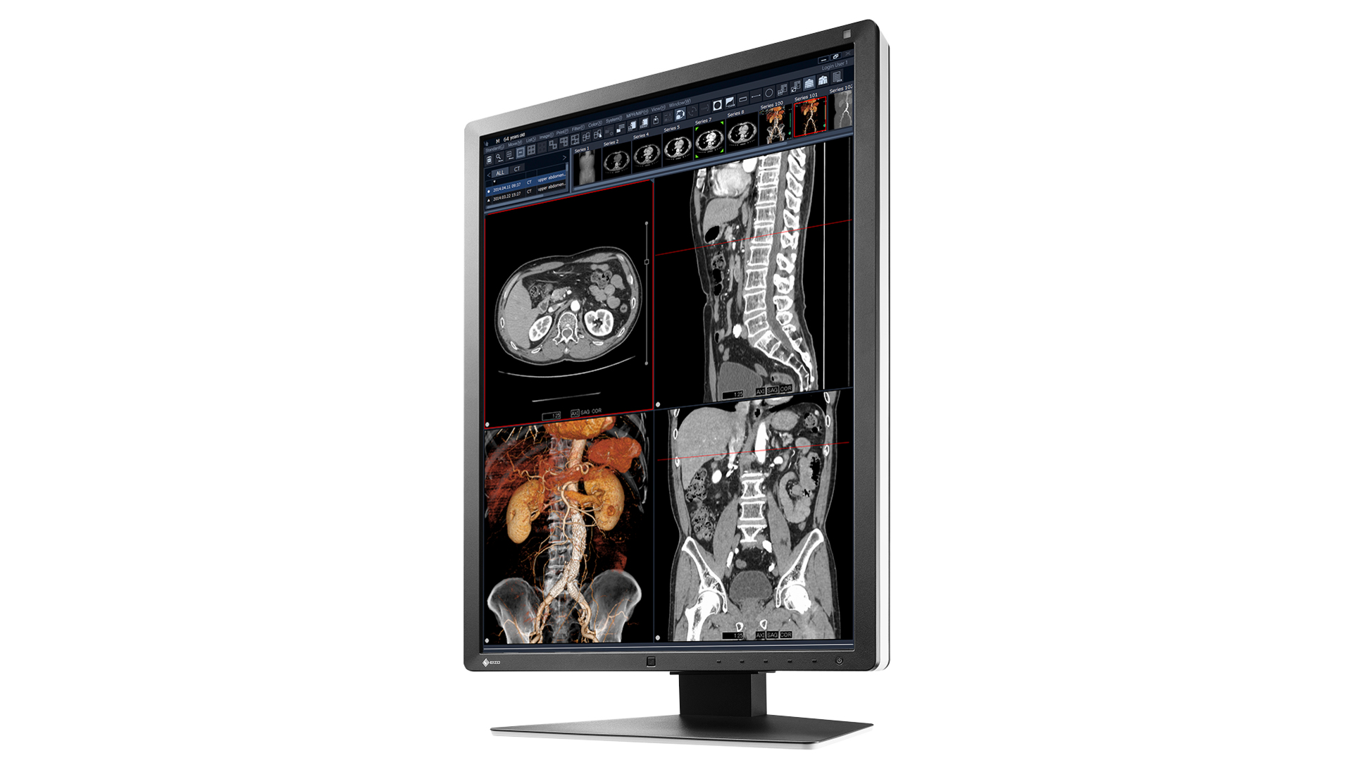 EIZO RadiForce RX250 computer monitor – image 2