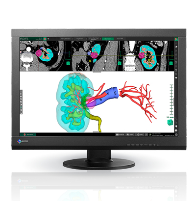 EIZO MX242W computer monitor